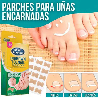Ingrown Toenails and Fungal Infections